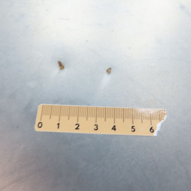 Capot occasion PEUGEOT 205 205 Phase 2 1987-07-01->1998-12-31 1.8 D 2