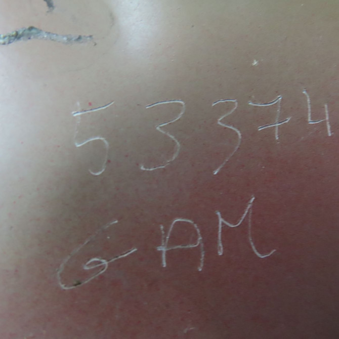 Aile avant droite occasion NISSAN JUKE Phase 1 09-2010->... 1.5 DCI 110ch F3A0M1KKAA 5